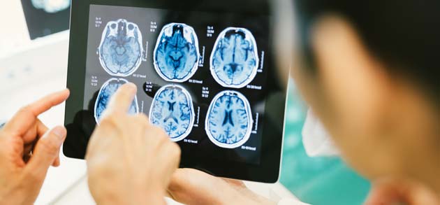Le Emergenze Urgenze in Neurologia