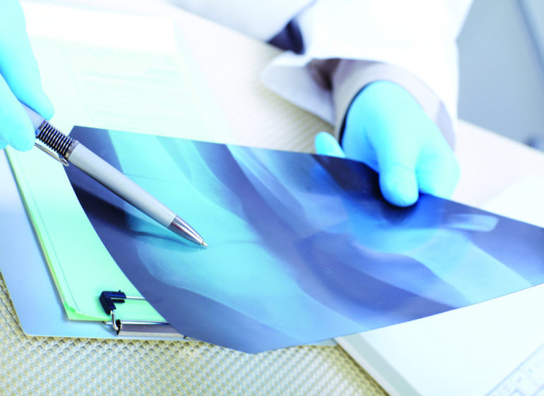 radiografia